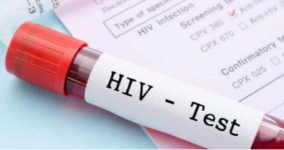 Logran un «caso excepcional» de curación funcional del sida