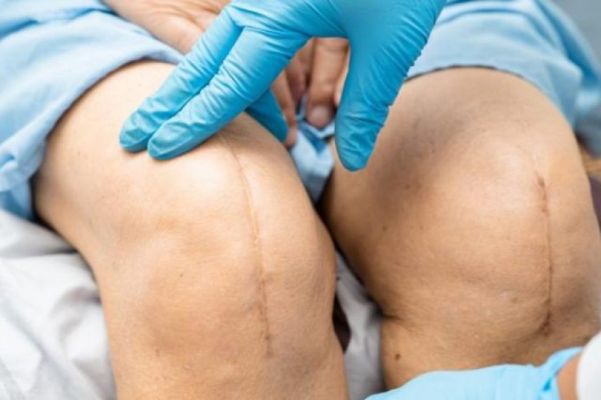 Accidentes de tránsito aumentan demanda de prótesis ortopédicas en el país